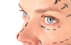 Directional lines on women's face