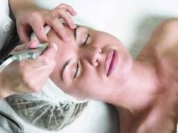 Femal Client getting Microdermabrasion on forehead